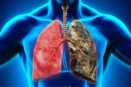 Thuốc lá thụ động nguy hiểm hơn cả trực tiếp hút thuốc