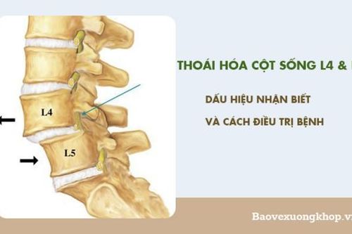 Thoái hóa đốt sống L4,5 có chữa dứt điểm được không?