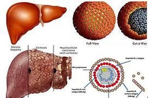 Bị viêm gan C không chữa trị có nguy hiểm không?