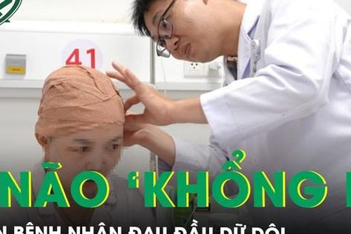 Đau đầu dữ dội bất ngờ mắc khối u não phức tạp, kích thước 'khổng lồ'
