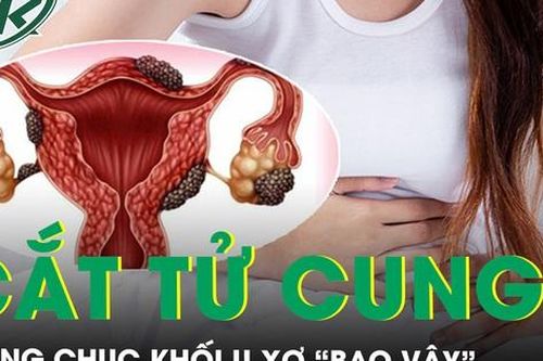 Đau đớn người phụ nữ phải cắt toàn bộ tử cung do hàng chục khối u xơ 'bao vây'