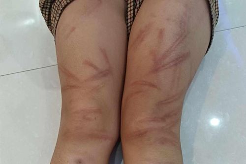 Xác minh nguyên nhân nhiều trẻ mầm non bị bạo hành tại Nghệ An