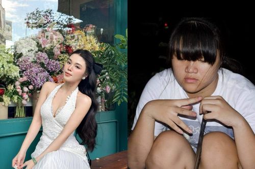 Gái xinh RMIT giảm cân thành công khiến bị đồn 'dao kéo'