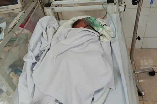 Xót xa bé gái sơ sinh khoảng 2 ngày tuổi bị bỏ rơi ở ven đường, nhiều bộ phận có dòi bọ