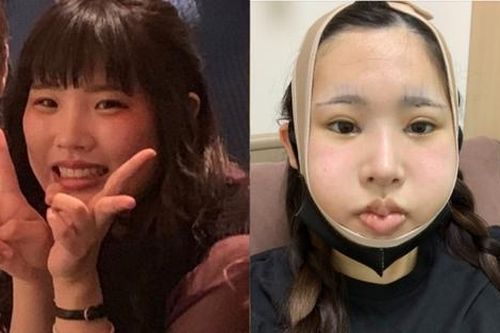 Nữ người mẫu chi 3,2 tỷ 'lột xác' sau khi bị tình cũ chê xấu và cái kết gây choáng