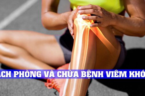 Ô nhiễm không khí có liên quan tới bệnh viêm khớp?