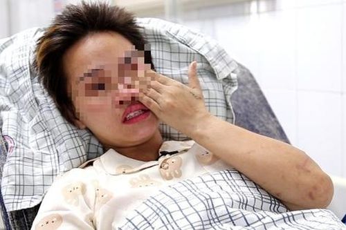 Nạn nhân ngừng tim, đa chấn thương do sạt lở đất đá ở Yên Bái được ra viện