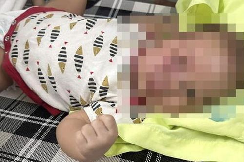Vụ bé 3 tháng tuổi nhập viện nghi bị cha bạo hành: Công an vào cuộc