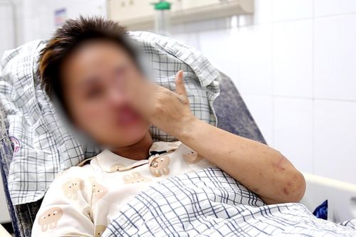 Nạn nhân bị ngừng tim được ra viện sau 20 ngày điều trị