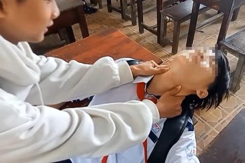 Học sinh thử 'bắt pen', bác sĩ cảnh báo hành động liều lĩnh