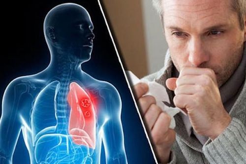 Người đàn ông 38 tuổi ở Phú Thọ đau họng, ho ra máu thừa nhận một sai lầm mà nhiều nam giới Việt mắc phải
