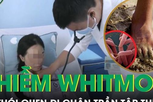 Nhiễm vi khuẩn nguy hiểm do thói quen đi chân trần tập thể dục