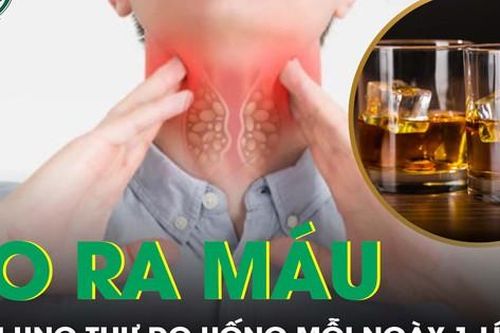 Có khối u nghi ung thư do thói quen mỗi ngày uống 1 lít rượu