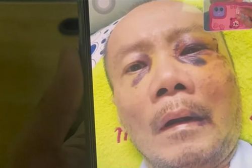 Ca sĩ Tô Thanh Phương 'Bài ca đất phương Nam': Tôi sốc vì sợ bị mù