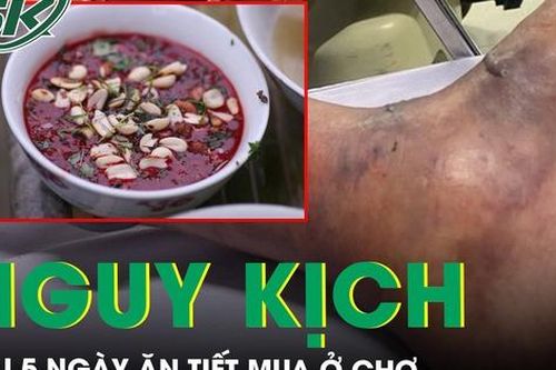 Nguy kịch sau 5 ngày ăn tiết mua ở chợ