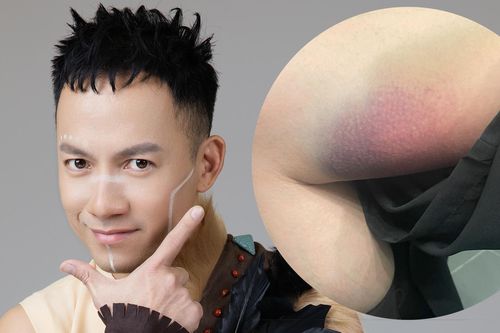 Tiến Đạt bị chấn thương sau đêm chung kết 1 'Anh trai vượt ngàn chông gai'