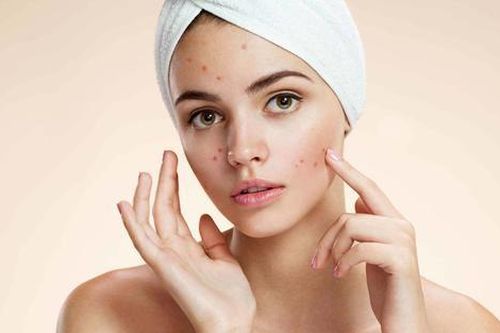 Xây dựng routine chăm sóc da mụn thế nào để đạt hiệu quả cao?