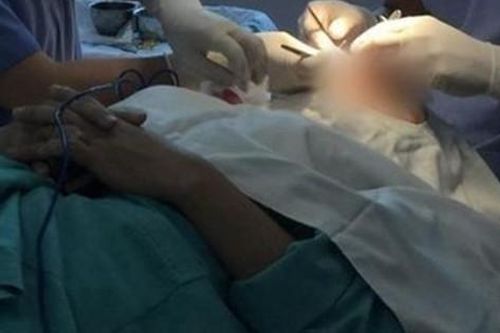 Chuyên gia nêu những tai biến thường xuất hiện khi phẫu thuật thẩm mỹ không an toàn