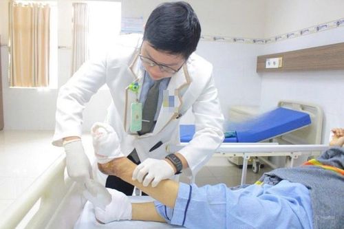 Người phụ nữ phải cắt ngón chân vì ngâm nước nóng