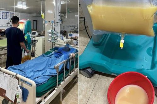 Người đàn ông 44 tuổi ở Tuyên Quang phải lọc máu trong đêm thừa nhận một sai lầm nhiều người Việt mắc phải