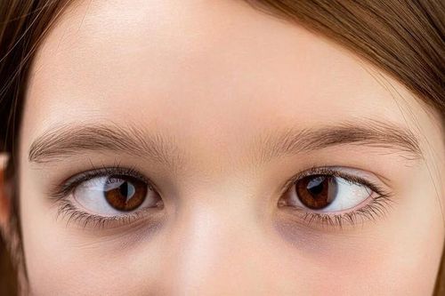 Lác mắt có trị được không?