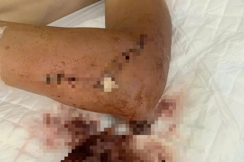 Truy tố Giám đốc doanh nghiệp dùng kiếm chém người làm thuê đến đòi nợ