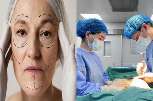 Trào lưu phẫu thuật thẩm mỹ tuổi xế chiều: Cơ hội làm đẹp hay rủi ro sức khỏe?