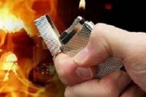 Điều tra vụ chồng dùng xăng đốt vợ bỏng 90% cơ thể