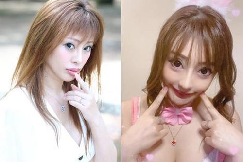 Nữ người mẫu phẫu thuật 300 lần vì bị mẹ chê xấu: Nhan sắc hiện tại khó tin