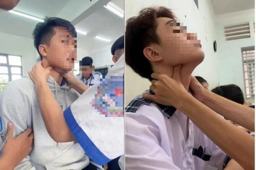 Từ trào lưu 'bắt pen': Dừng lại khi chưa muộn!