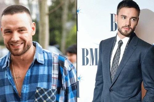 Những 'cuộc chiến' về sức khỏe của Liam Payne được tiết lộ