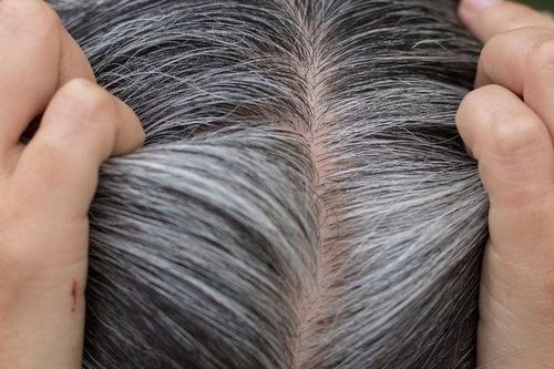 Nguyên nhân khiến tóc bạc sớm và cách khắc phục