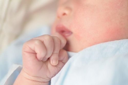 Bé trai 10 tháng tuổi yếu mềm hai chân chỉ sau 2 ngày sốt