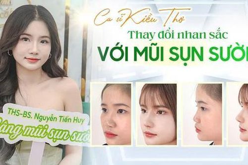 Ca sĩ Kiều Thơ: Thay đổi nhan sắc với mũi sụn sườn