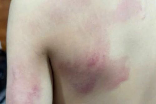 Giáo viên đánh học sinh, vì đâu nên nỗi?
