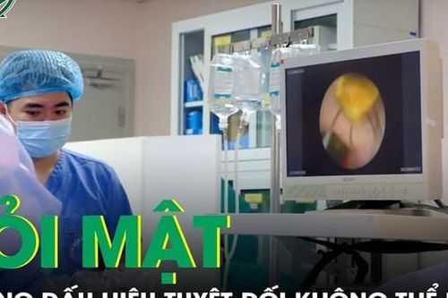 Sỏi túi mật: Những dấu hiệu phát hiện bệnh sớm tuyệt đối không thể chủ quan