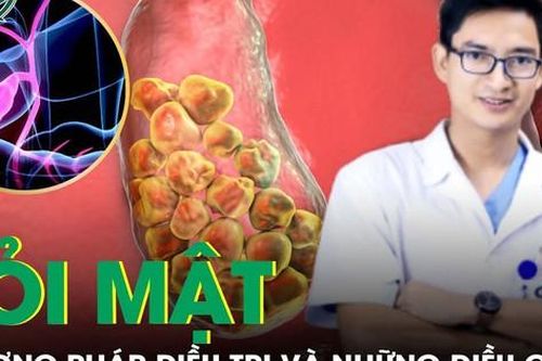 Phương pháp điều trị sỏi mật phổ biến nhất hiện nay và những điều cần biết