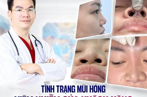 Lấy lại vẻ đẹp hoàn mỹ sau 2 lần nâng mũi thất bại