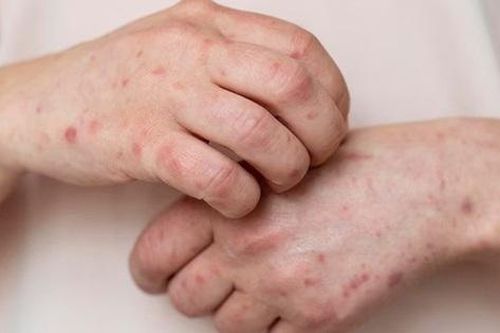7 dấu hiệu trên da cảnh báo bệnh tim