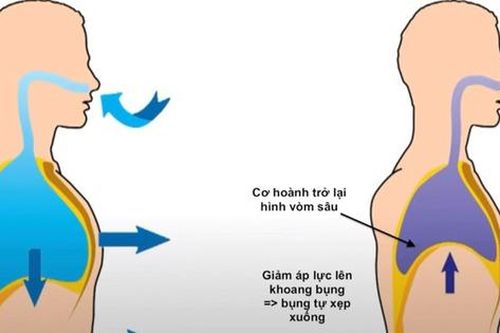 Bài tập cho người mắc hội chứng Lyell