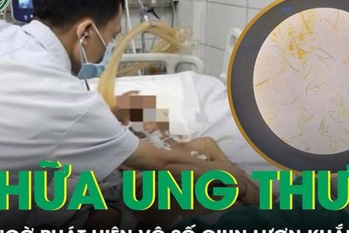 Bệnh nhân ung thư suy kiệt, xét nghiệm phát hiện vô số giun lươn trong người