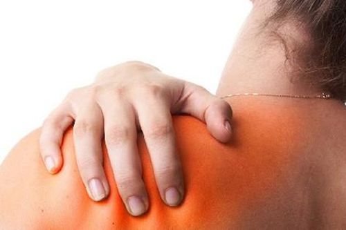 Hạn chế chấn thương khớp vai trong luyện tập thể thao