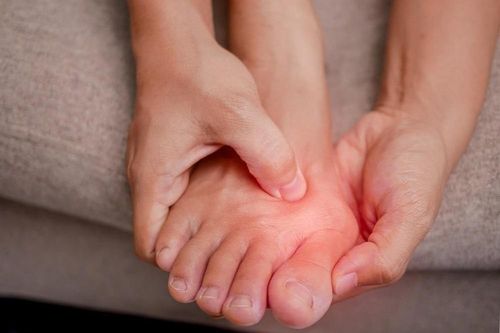 6 thói quen làm tăng nguy cơ gout, cần thay đổi sớm