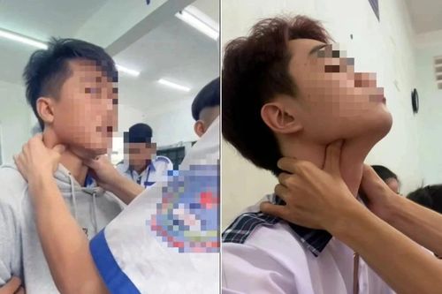 Nguy cơ tử vong từ 'bắt pen'