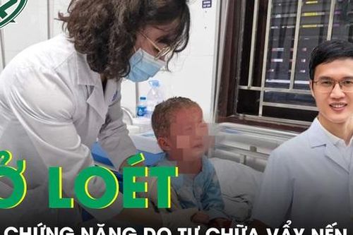 Em bé lở loét khắp người biến chứng nặng do cha mẹ tự chữa vẩy nến