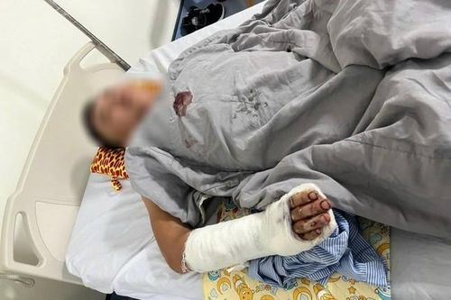 Hà Nội: 2 người bị chém trọng thương ở quán gội đầu
