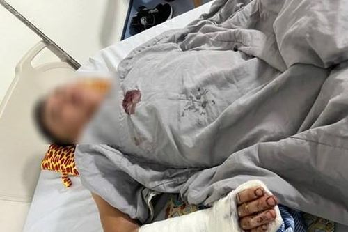Rủ đồng bọn dùng kiếm chém người chỉ vì câu nói 'không phải việc của mày'