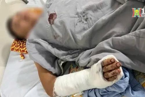 Hai người bị chém trọng thương ở quán gội đầu