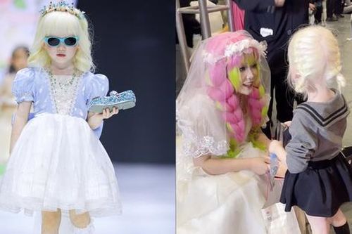 Cô bé bạch tạng gây sốt với câu chuyện vượt qua mặc cảm nhờ đi lễ hội cosplay