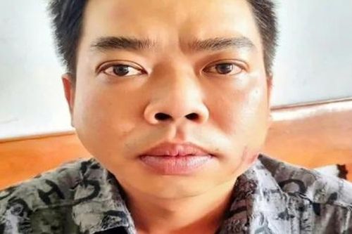 Mâu thuẫn khi hát karaoke, người đàn ông tấn công bạn nhậu